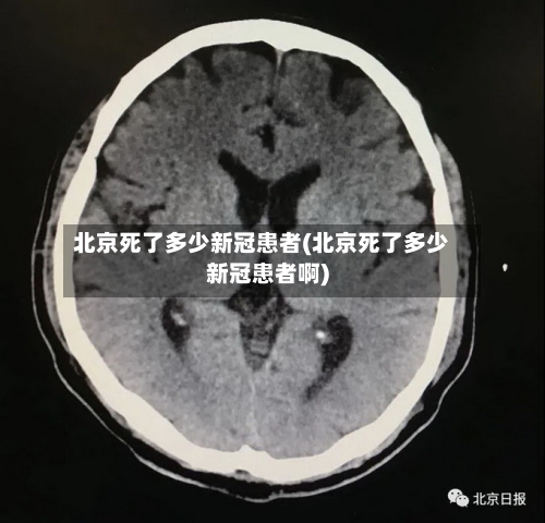 北京死了多少新冠患者(北京死了多少新冠患者啊)